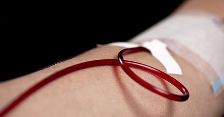 Tak poznasz, że masz "lepką krew". Ryzyko skrzepów wzrasta