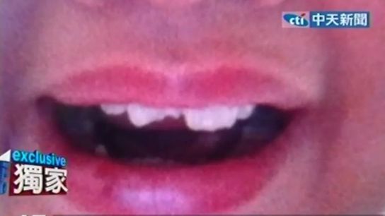 iPad może wybić Ci zęby! 1