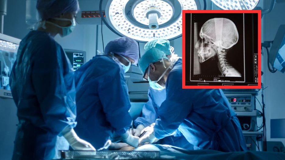 Operował 33-latka z urazem głowy. Na salę operacyjną zaprosił 13-letnią córkę