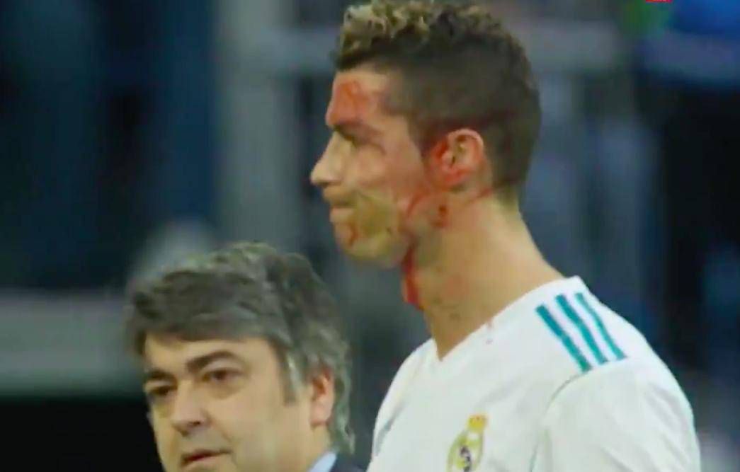 Ronaldo miał wypadek podczas ostatniego meczu