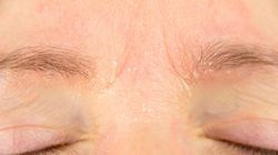 Produkty nasilające objawy egzemy. #ZdrowaPolka