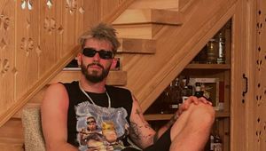 Hit. Tylko spójrz na "fryzurę" Fornala