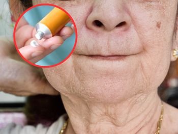 Niedoceniana maść z apteki. Zimą potrafi zdziałać więcej niż drogie kremy