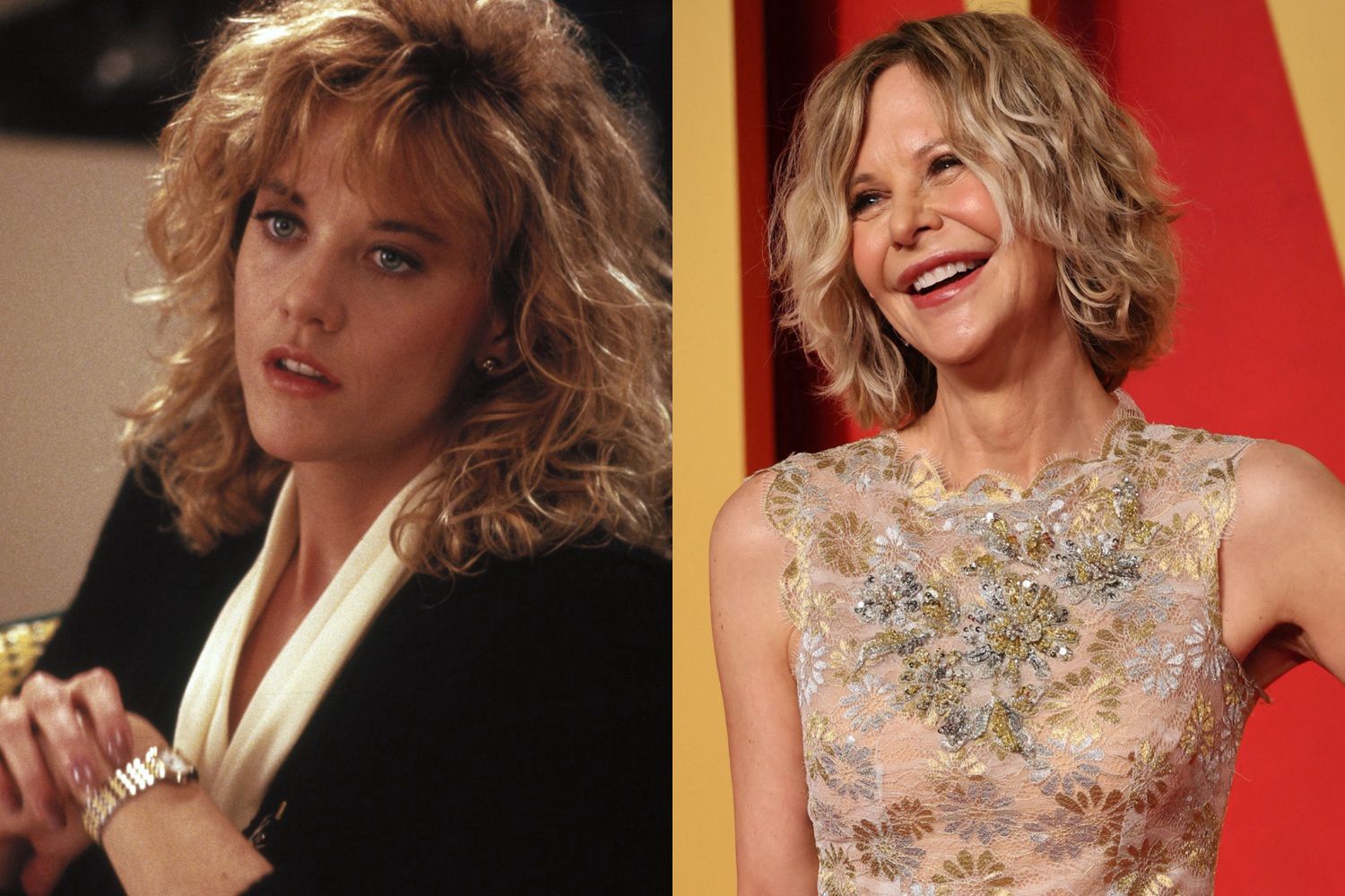 Meg Ryan i medycyna estetyczna