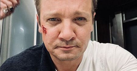 Jeremy Renner przeszedł operację. Rodzina gwiazdora zabrała głos