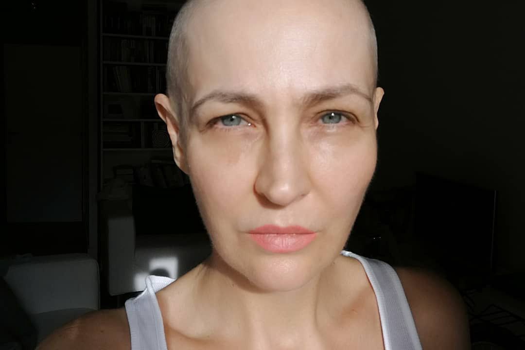 Anna Puślecka walczyła o refundację leku na raka. Teraz zmaga się z innym problemem