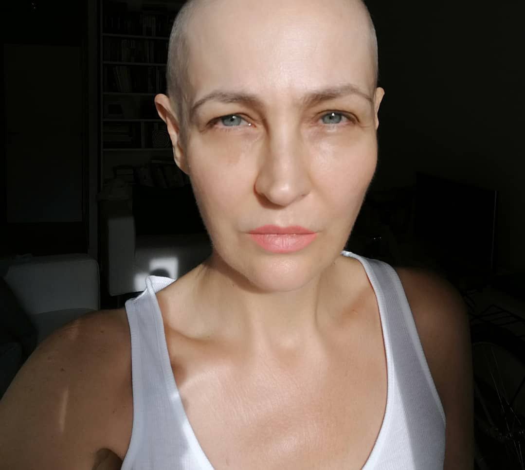 Anna Puślecka walczyła o refundację leku na raka. Teraz zmaga się z innym problemem