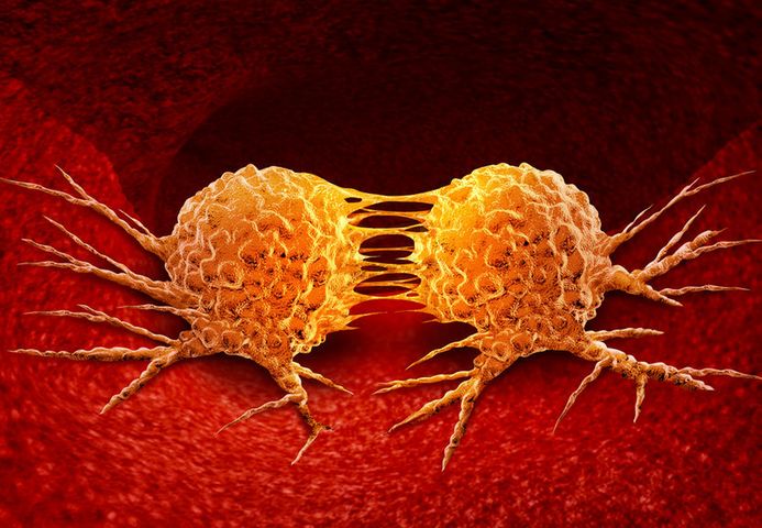 Kancerogeneza to proces wytwarzania w organizmie nieprawidłowych komórek nowotworowych oraz ich nadmierny rozrost