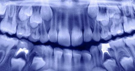 Zajrzał do buzi 7-latka. Dentysta osłupiał
