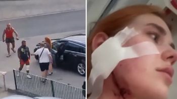 Pobici Ukraińcy opowiadają, co się wydarzyło. "Dostałam w twarz"