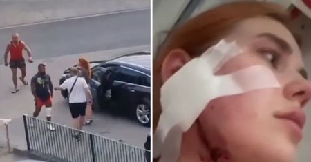 Pobici Ukraińcy opowiadają, co się wydarzyło. "Dostałam w twarz"