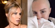 Blanka Lipińska tajemniczo zasłania twarz i ogłasza, że zafundowała sobie KOLEJNE POPRAWKI. "Zabieg się udał"