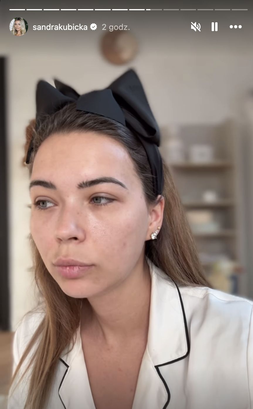  Sandra Kubicka rozprawia o rozstaniu