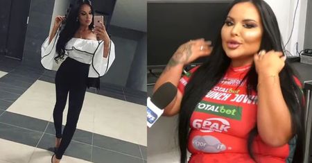 Esmeralda Godlewska promuje turniej w... policzkowaniu i grozi: "Za kilka miesięcy przejdę METAMORFOZĘ"