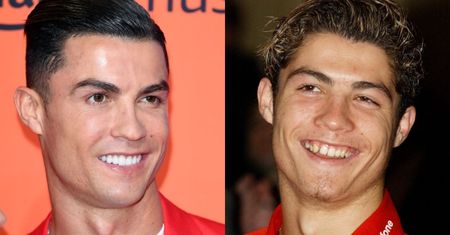 Cristiano Ronaldo kończy 40 LAT! Eksperci wyliczają, jakim zabiegom się poddał: nowe zęby, przeszczep włosów...