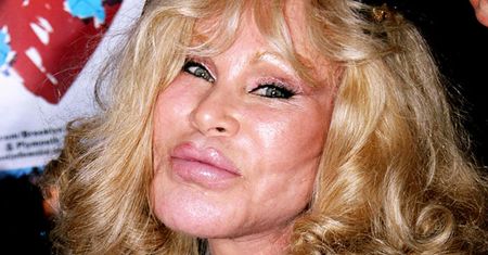 Jocelyn Wildstein znana jako "Kobieta-Kot" zarobiła krocie na rozwodzie. Jak żyje dziś?