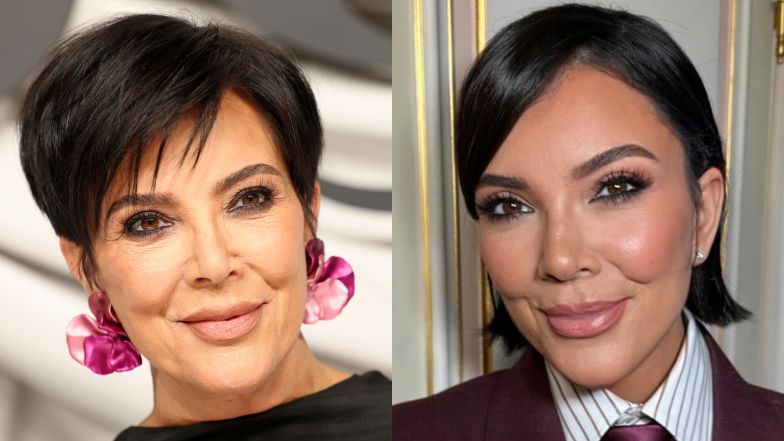 Lekarze wyliczają operacje Kris Jenner 