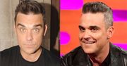 Robbie Williams wyznaje, że ingerował w wygląd: "Nie mogłem, ku*wa, ruszyć czołem!"
