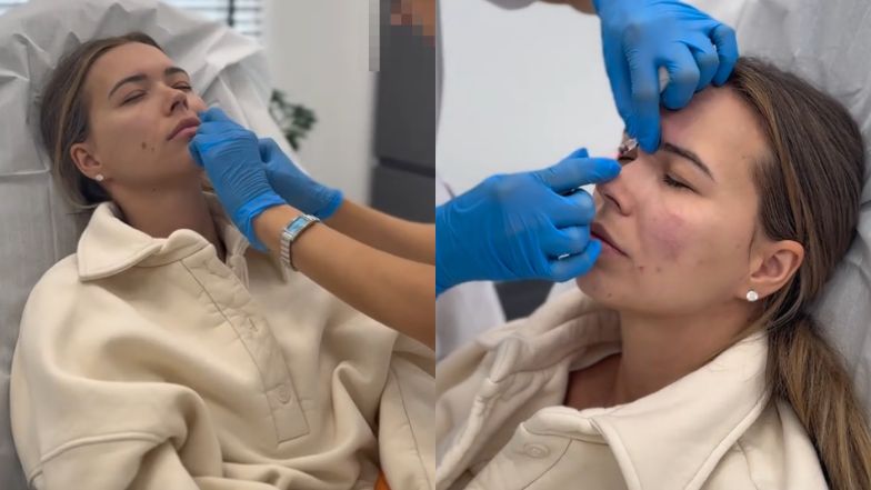 Sandra Kubicka w klinice medycyny estetycznej