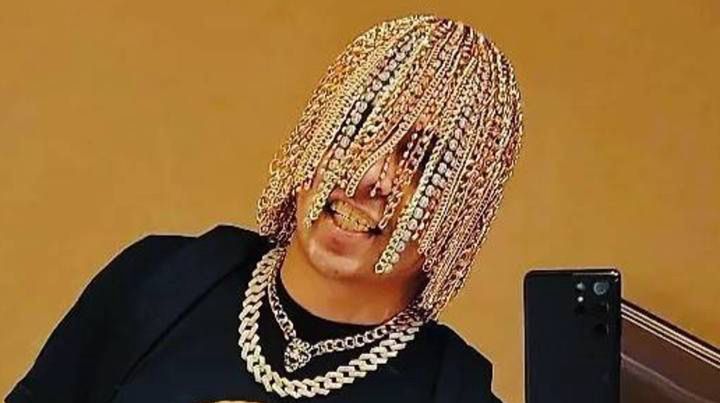 Raper Dan Sur wczepił sobie w głowę złote łańcuchy, które zastąpiły jego włosy
