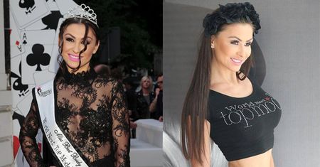 Andżelika Fajcht: "Wypadł mi dysk, muszę chodzić w gorsecie"
