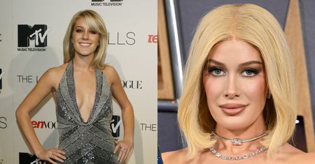 Heidi Montag przeszła 10 OPERACJI PLASTYCZNYCH jednego dnia. Po latach przyznała, że żałuje: "Urżnęli mi kawał brody. Ledwo mówiłam"
