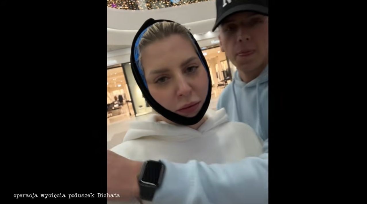 Tak Julia von Stein walczyła o wymarzony wygląd