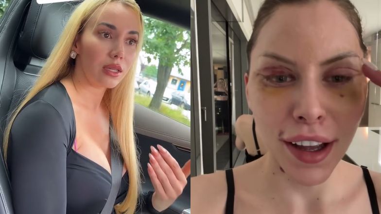 Maranna Schreiber tłumaczy się z krytyki Julii von Stein