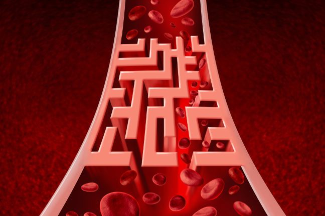 Zylaki powstają, gdy krew w naszych żyłach nie przepływa w sposób prawidłowy. Warto więc unikać długotrwałego stania, siedzenia i zakładania nogi na nogę