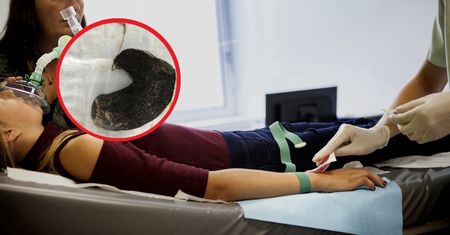 Wyjęli to z brzucha 9-latki. "Krzyczała z bólu"