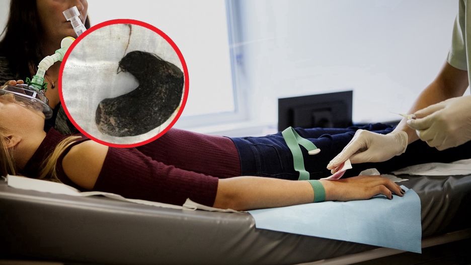 9-latka wymiotowała i mdlała. Oto co wyciągneli z jej brzucha lekarze