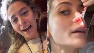 Córka Michaela Jacksona ma DZIURĘ W NOSIE przez narkotyki: "Zrujnowało mi to życie"