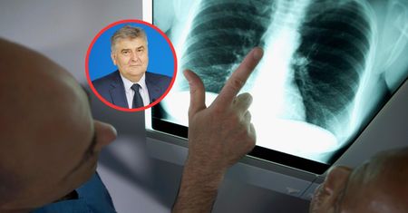 Chorych przybywa w rekordowym tempie. Wirus groźniejszy niż grypa
