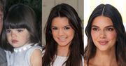 Kendall Jenner kończy 28 lat! Modelkę podejrzewa się o WIELE ingerencji w urodę. Zobaczcie, jak zmieniała się na przestrzeni lat (ZDJĘCIA)