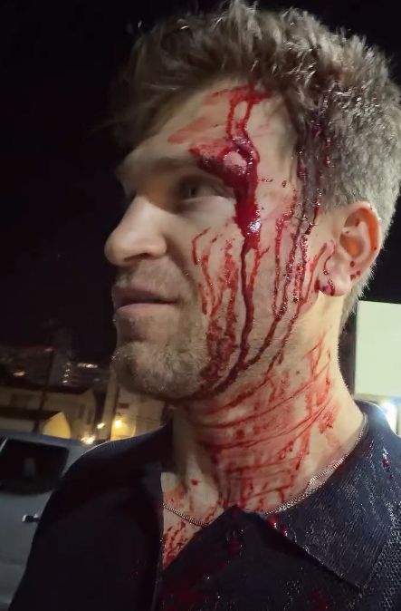 Keegan Allen