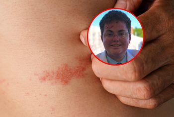 "Choroba motylich skrzydeł". Walczy o pomoc dla chorych na rzadkie schorzenie