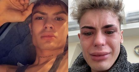 Aspirujący model zrobił sobie zęby w Turcji. Teraz żałuje. "Wyglądam jak rekin" (FOTO)