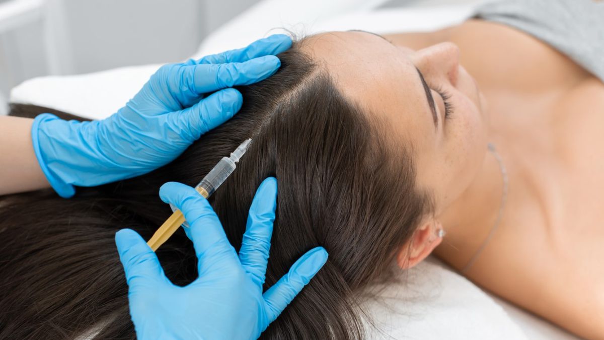 Mezoterapia igłowa wskazana jest w przypadku wypadania włosów.