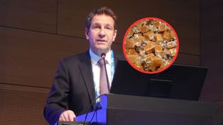 "Ogranicz spożycie". Hepatolog mówi, co niszczy wątrobę