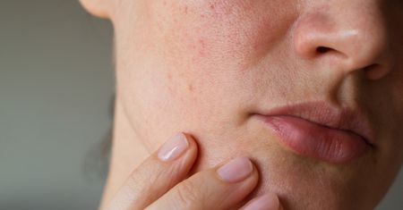 Zaburzenia hormonalne – objawy, przyczyny, badania i leczenie