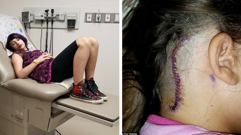 Lekarze myśleli, że za dolegliwości dziewczyny odpowiada dojrzewanie. Okazało się jednak, że to poważna choroba