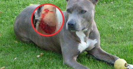Pani Sylwia pokazała ranną nogę. Amstaff zaatakował kobietę