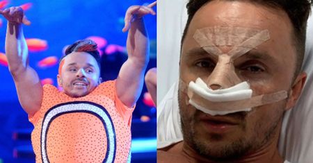 Qczaj broni swojego nowego nosa w "DDTVN": "Operacje plastyczne nie są tylko dla pań!"