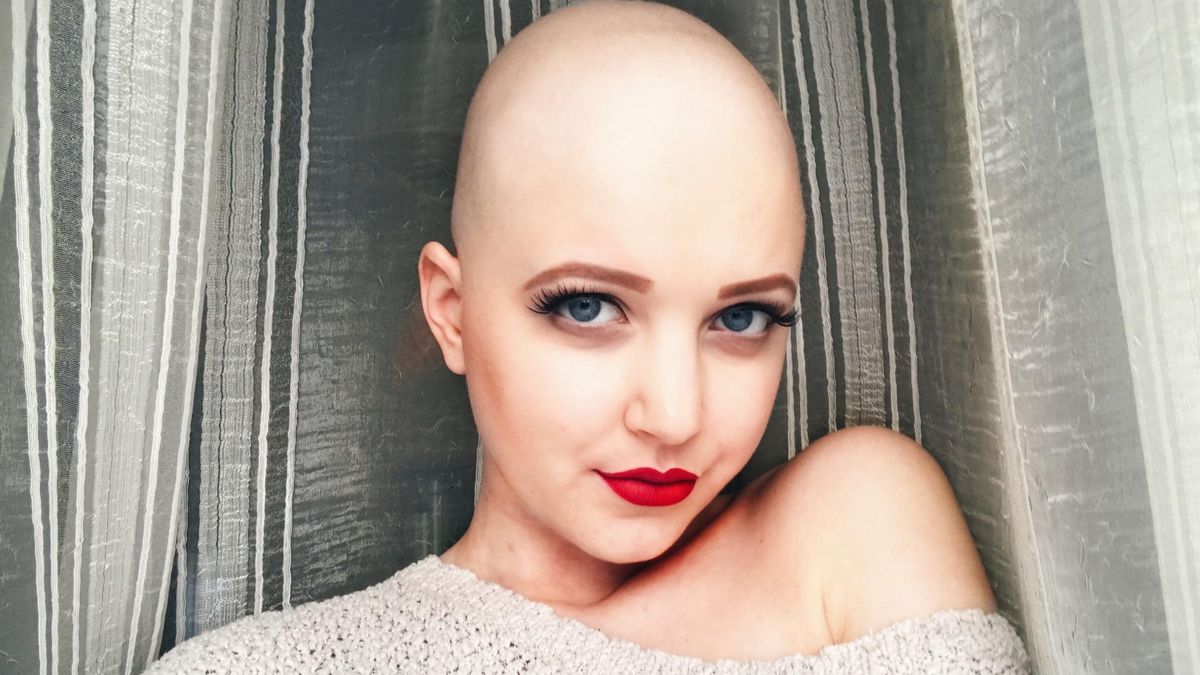 Claudia Kowalewska pokazuje, że nawet podczas chemioterapii można świetnie wyglądać