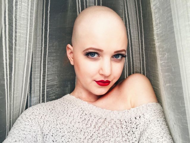 Claudia Kowalewska pokazuje, że nawet podczas chemioterapii można świetnie wyglądać