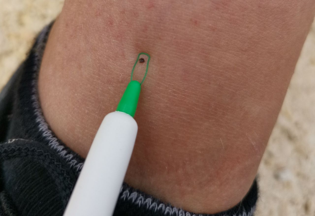 Kleszcze nie znoszą tej grupy krwi. Od tych osób trzymają się z daleka