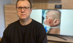 Znowu śmierć po interwencji. Zmarły to brat policjanta