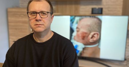 Znowu śmierć po interwencji. Zmarły to brat policjanta