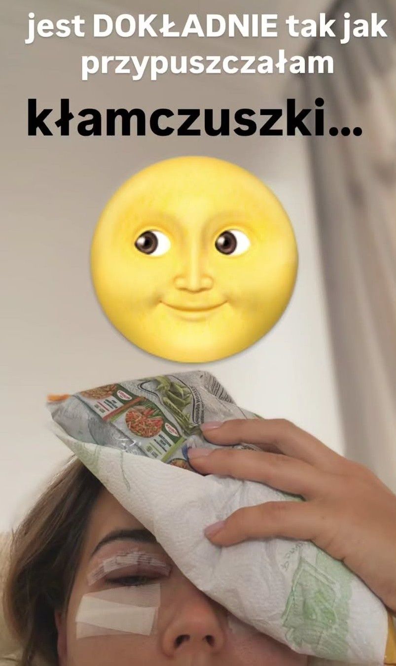 Sandra Kubicka po operacji powiek