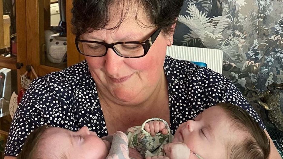 Na przeżycie rozdzielenia bliźniaczki miały tylko 7,5 proc. szans